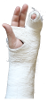 Hand and wrist fracture