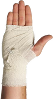 Hand or wrist sprain