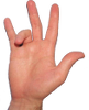 Trigger finger